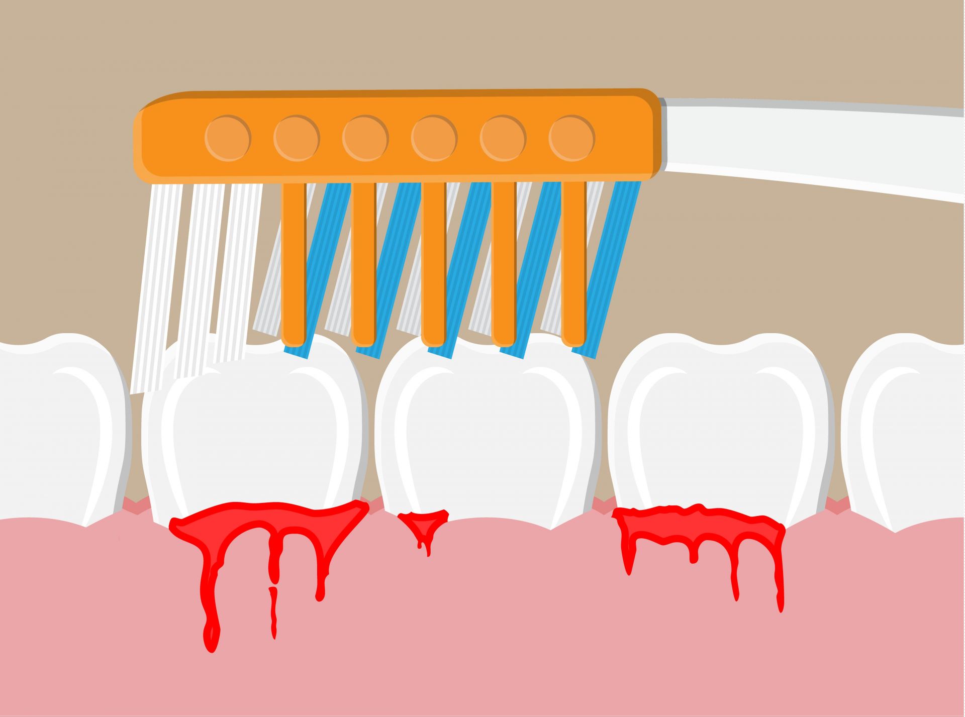 2020牙醫推薦資訊，植牙、洗牙的人都要看一下的